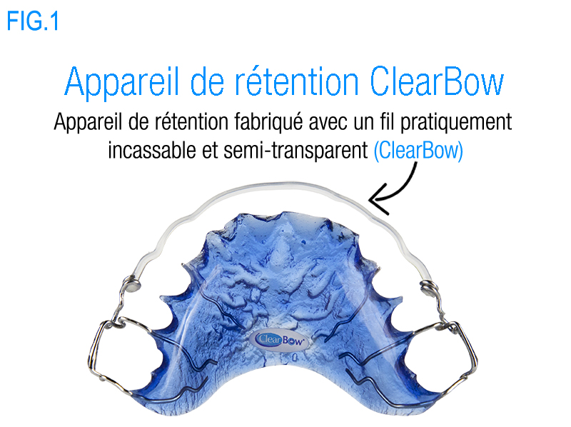blue_clearbow_retainer_intro_french