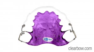 purple_clearbow_retainer
